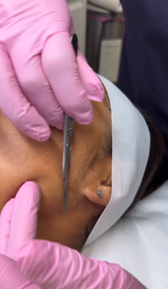 Dermaplane Session Photo.png