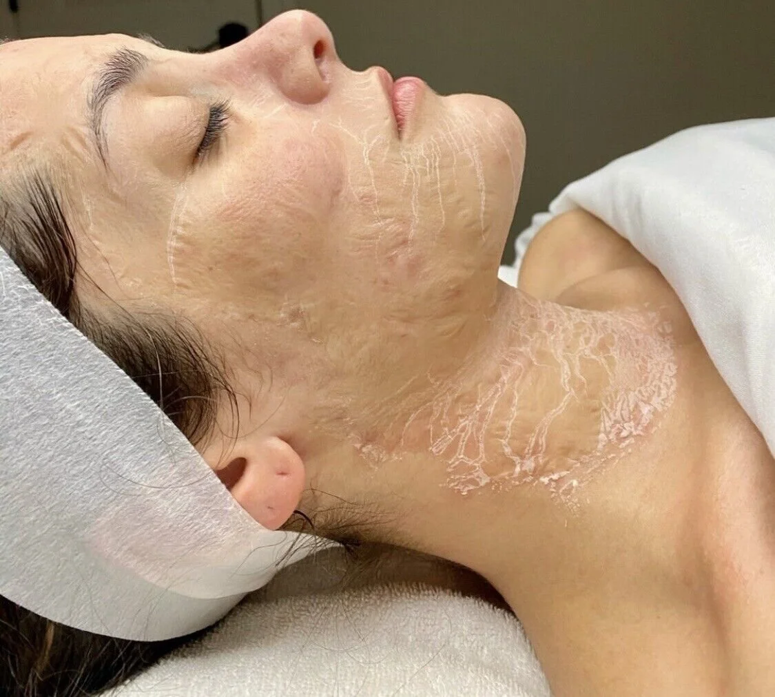 lymphatic facial melbourne edmk enzyme facial melbourne best skin therapist melbourne