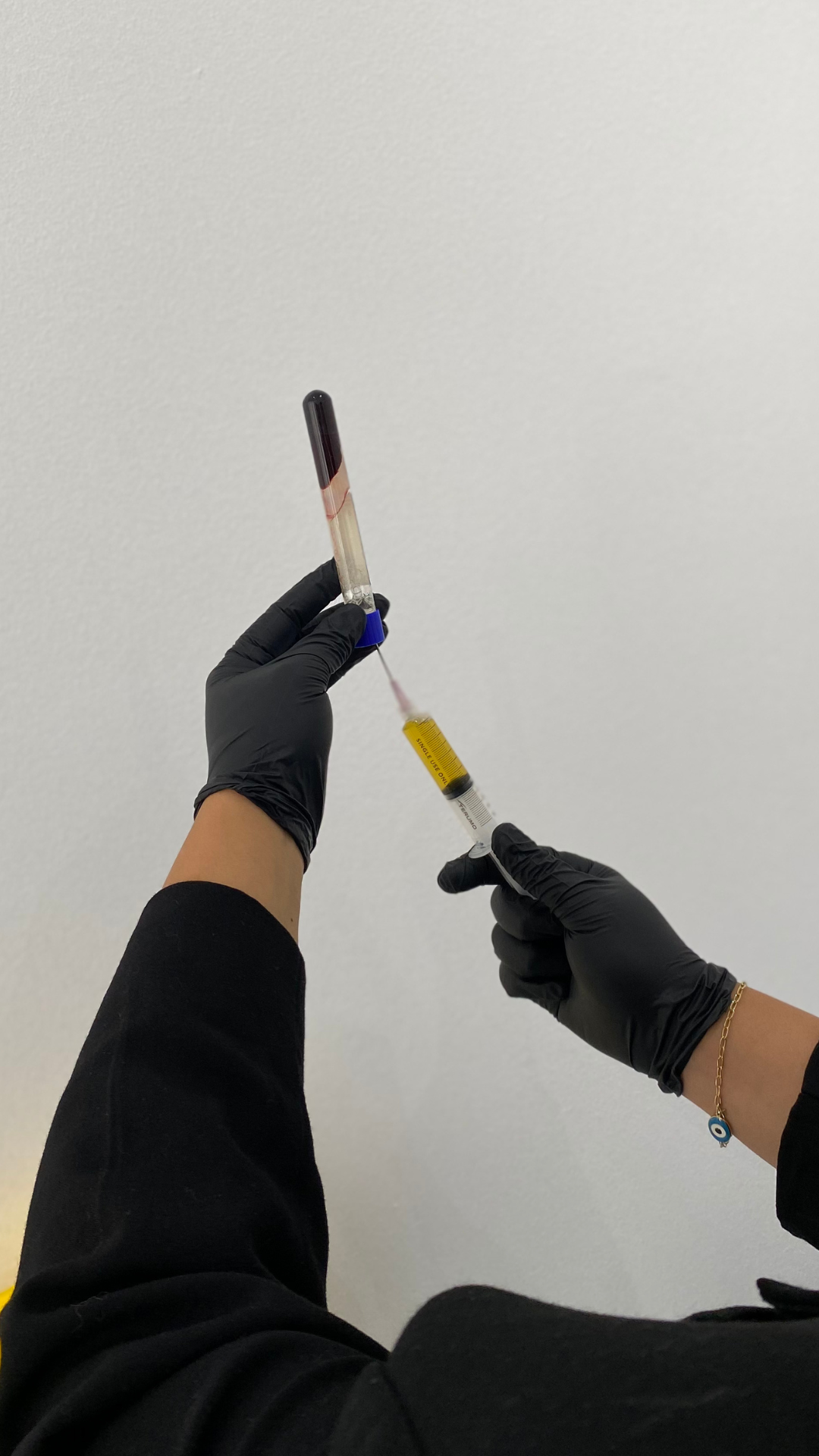 platelet rich plasma for hair loss and skin rejuvenation 