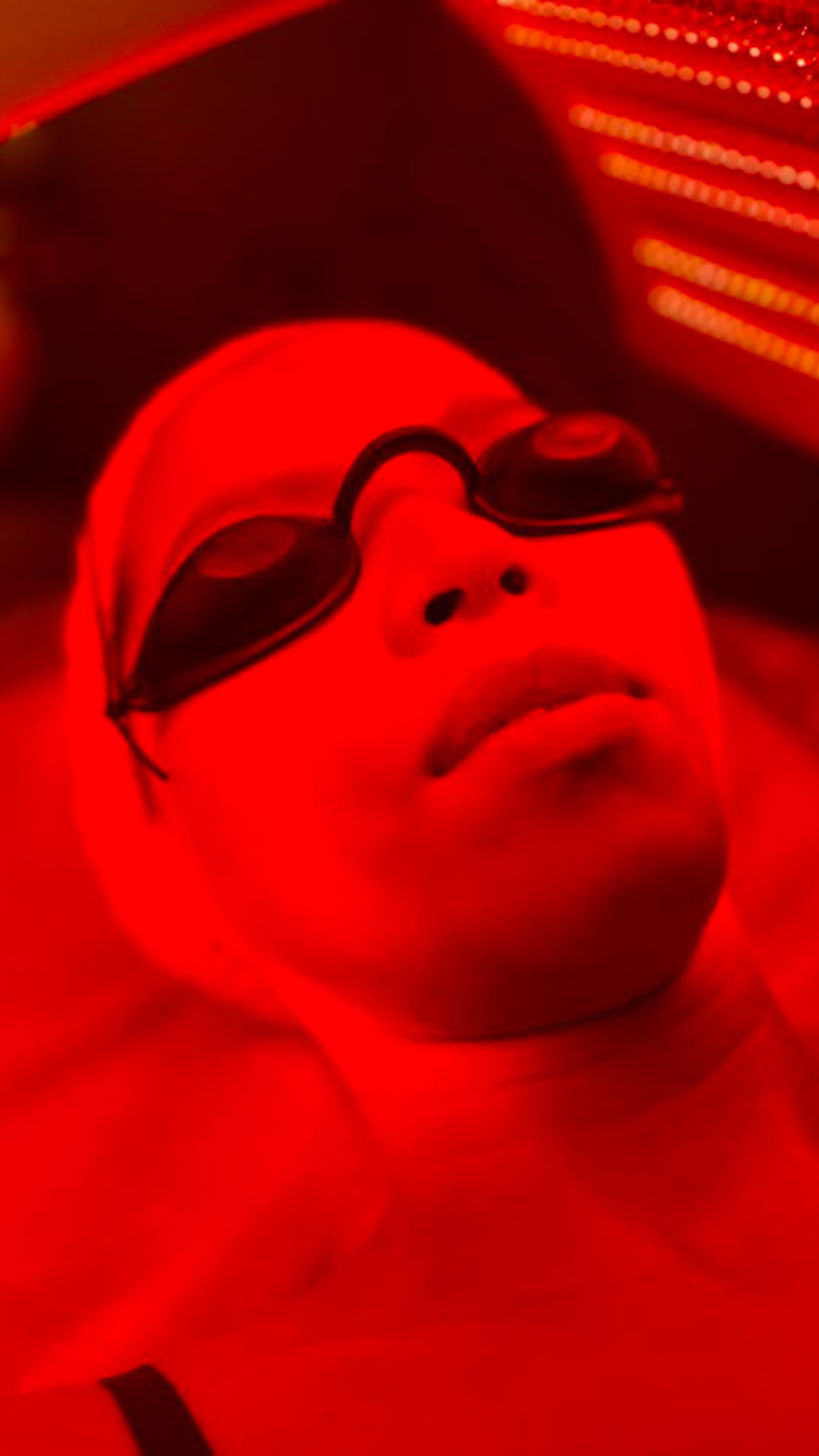 led red light therapy melbourne best skin melbourne skin clinic cosmetic injector melbourne skin healing melbourne prahran