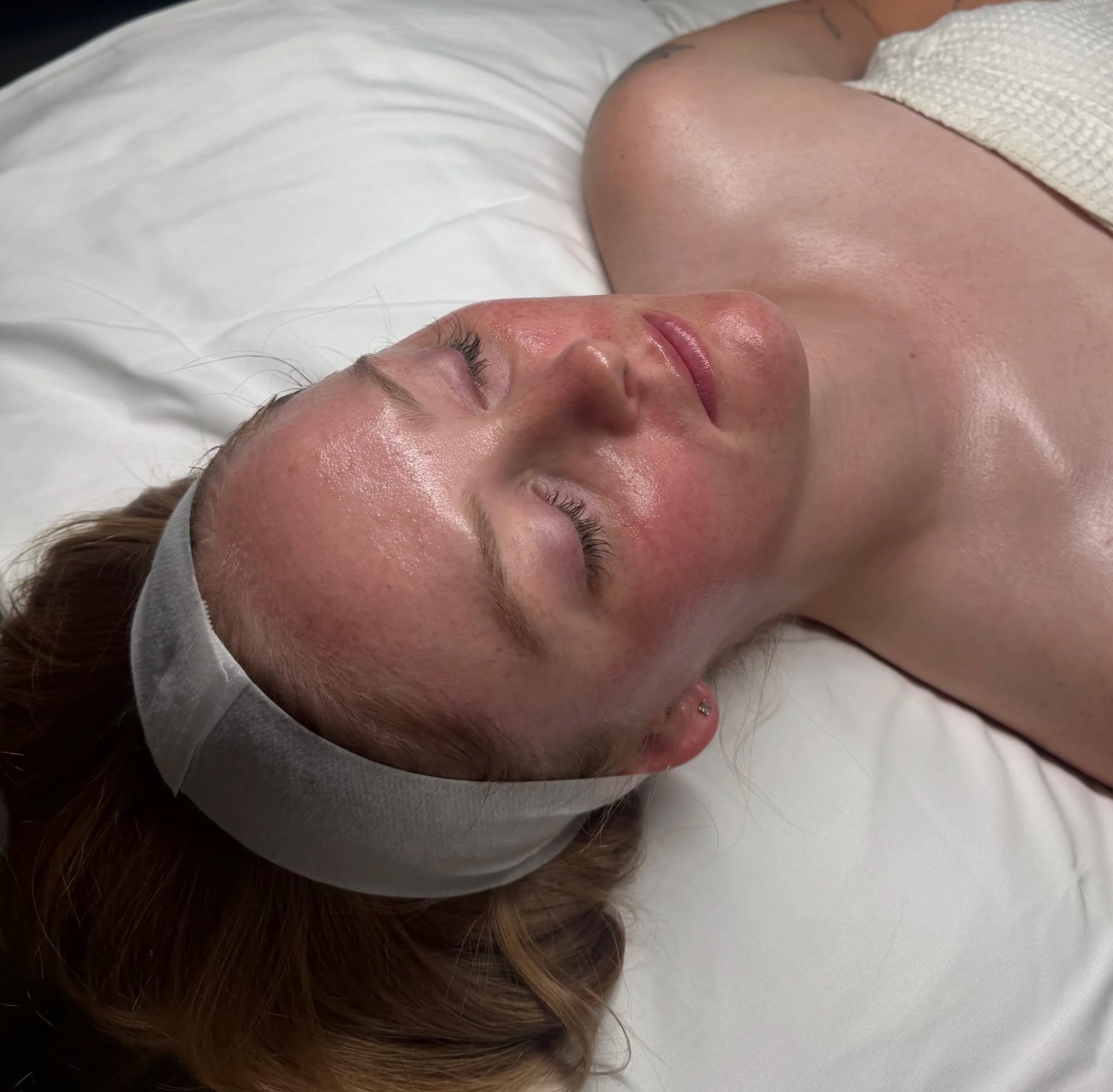 hydrafacial indiana