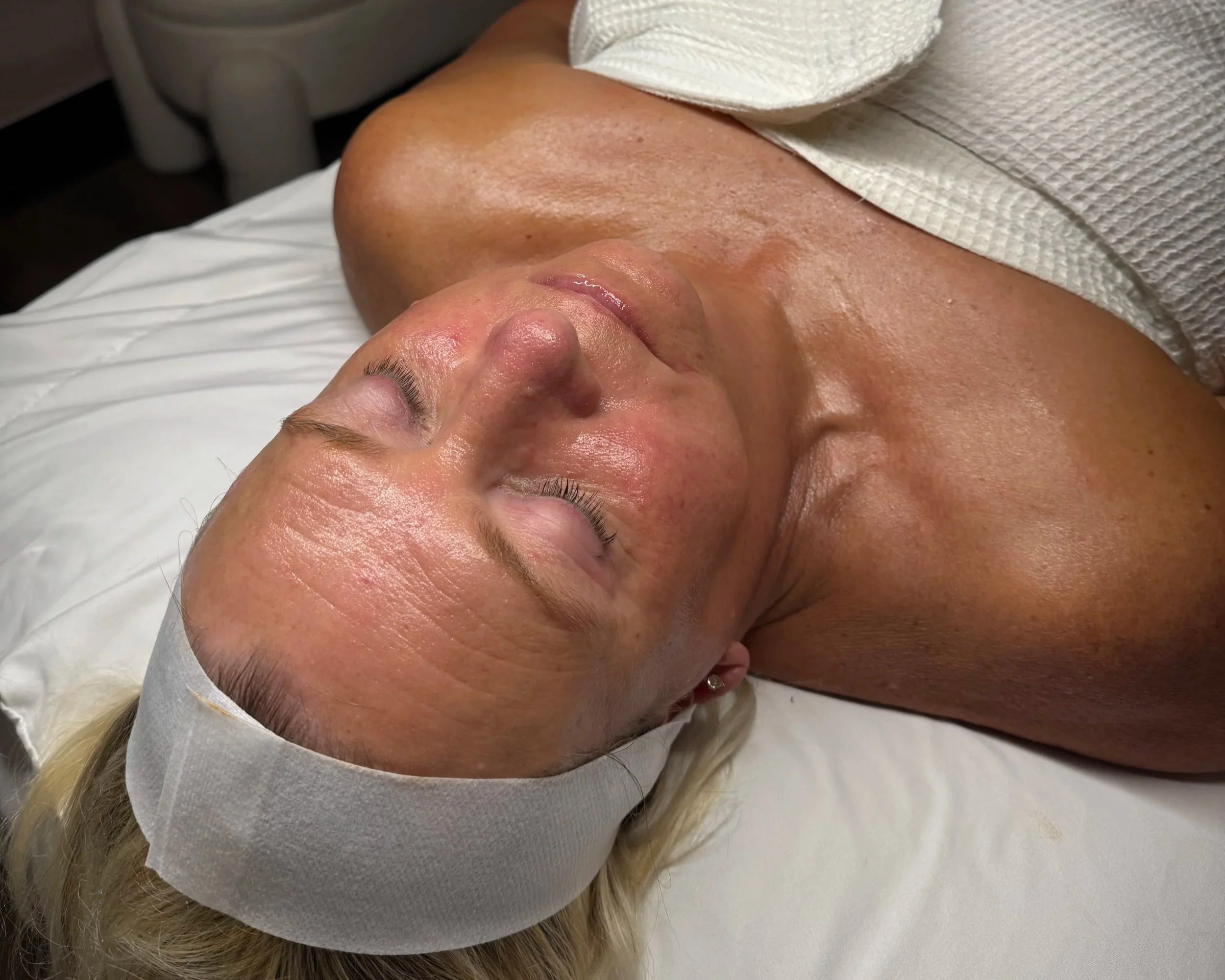 indiana hydrafacial