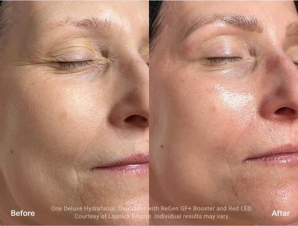 Side-by-side comparison of a woman's face showing before and after skincare treatment, with improved skin smoothness and brightness after treatment.