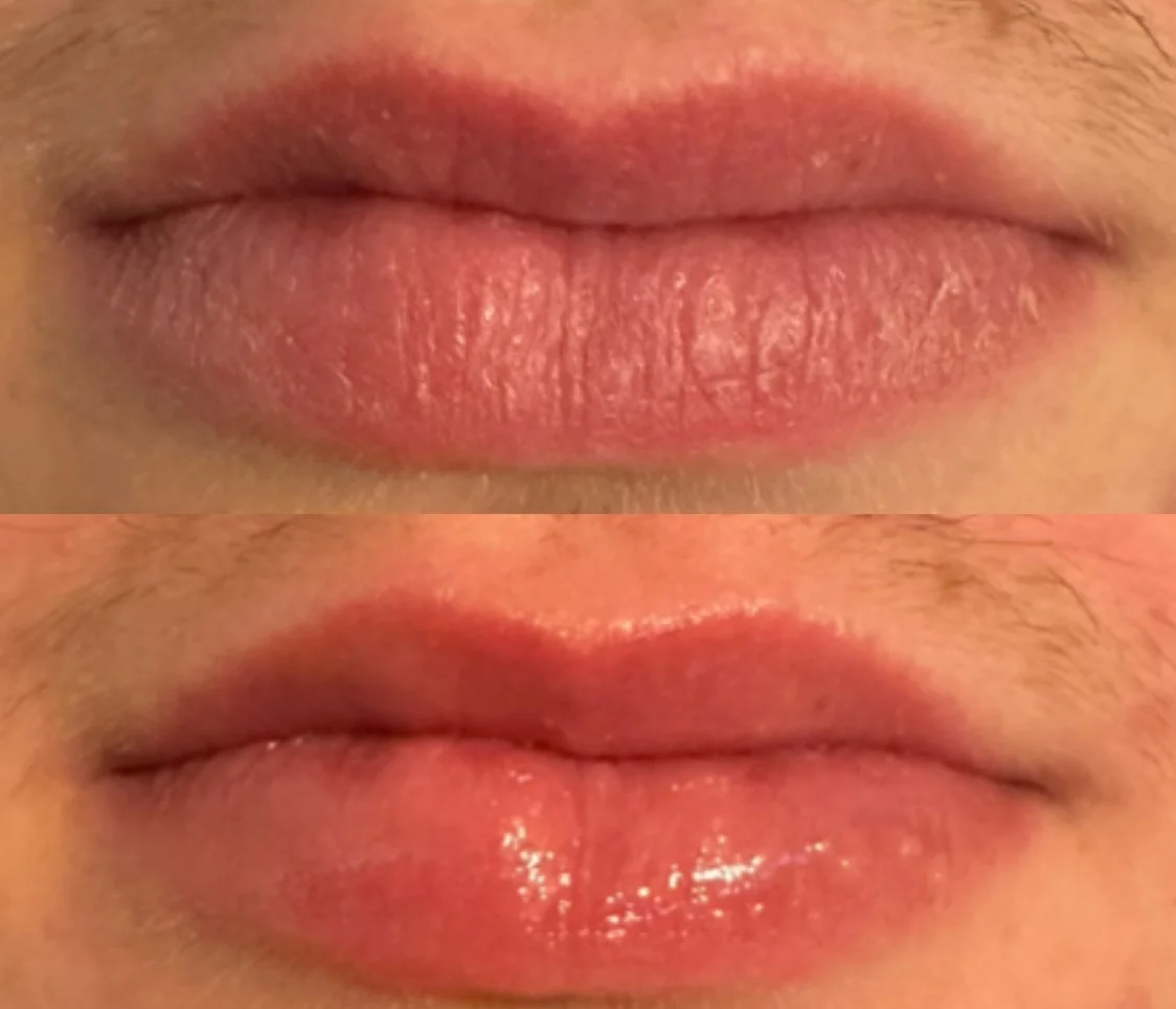 Close-up of human lips before and after applying lip gloss, showing differences in texture and shine.