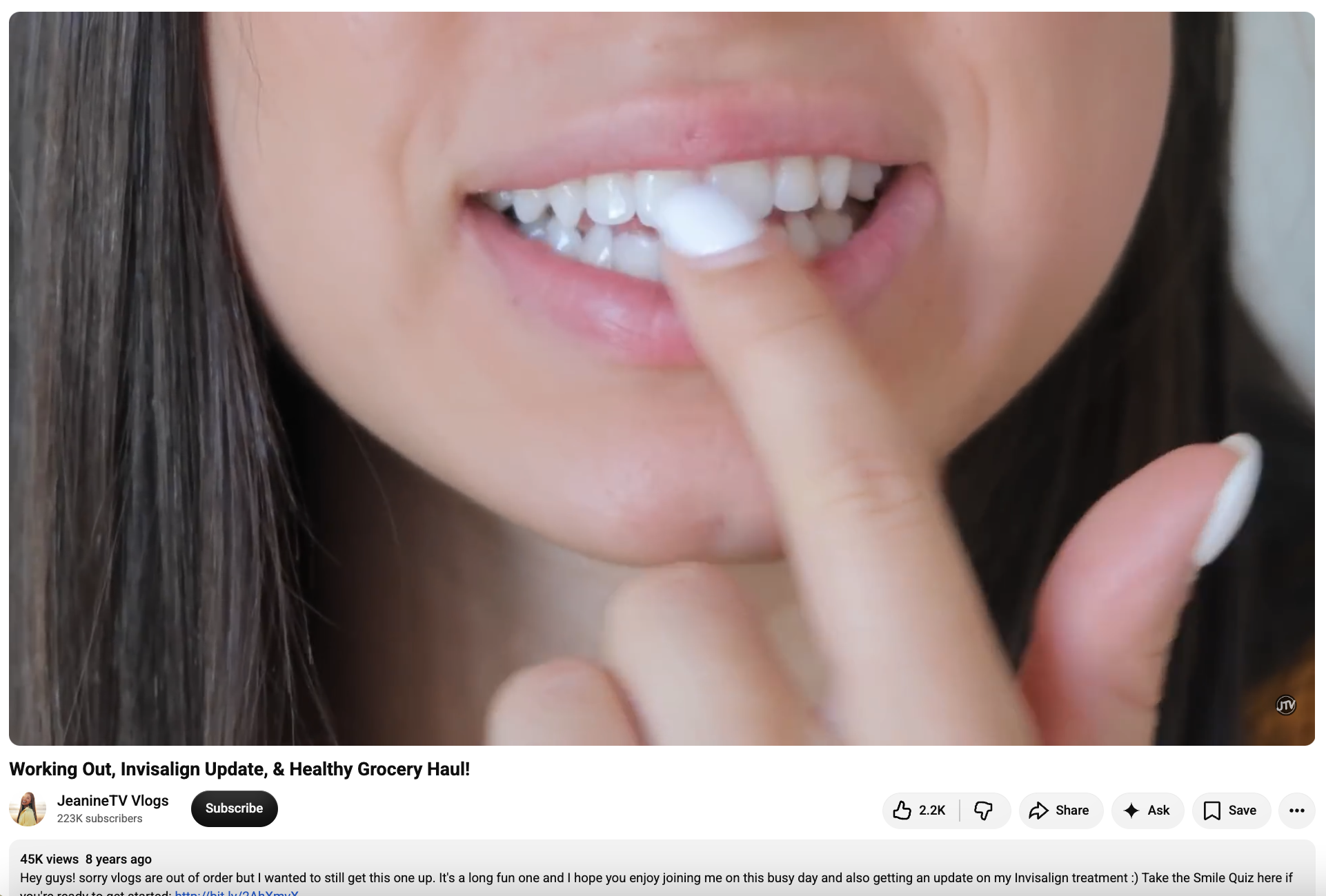 JeanineTV Vlogs sharing a follow-up update on her Invisalign treatment in a sponsored YouTube video