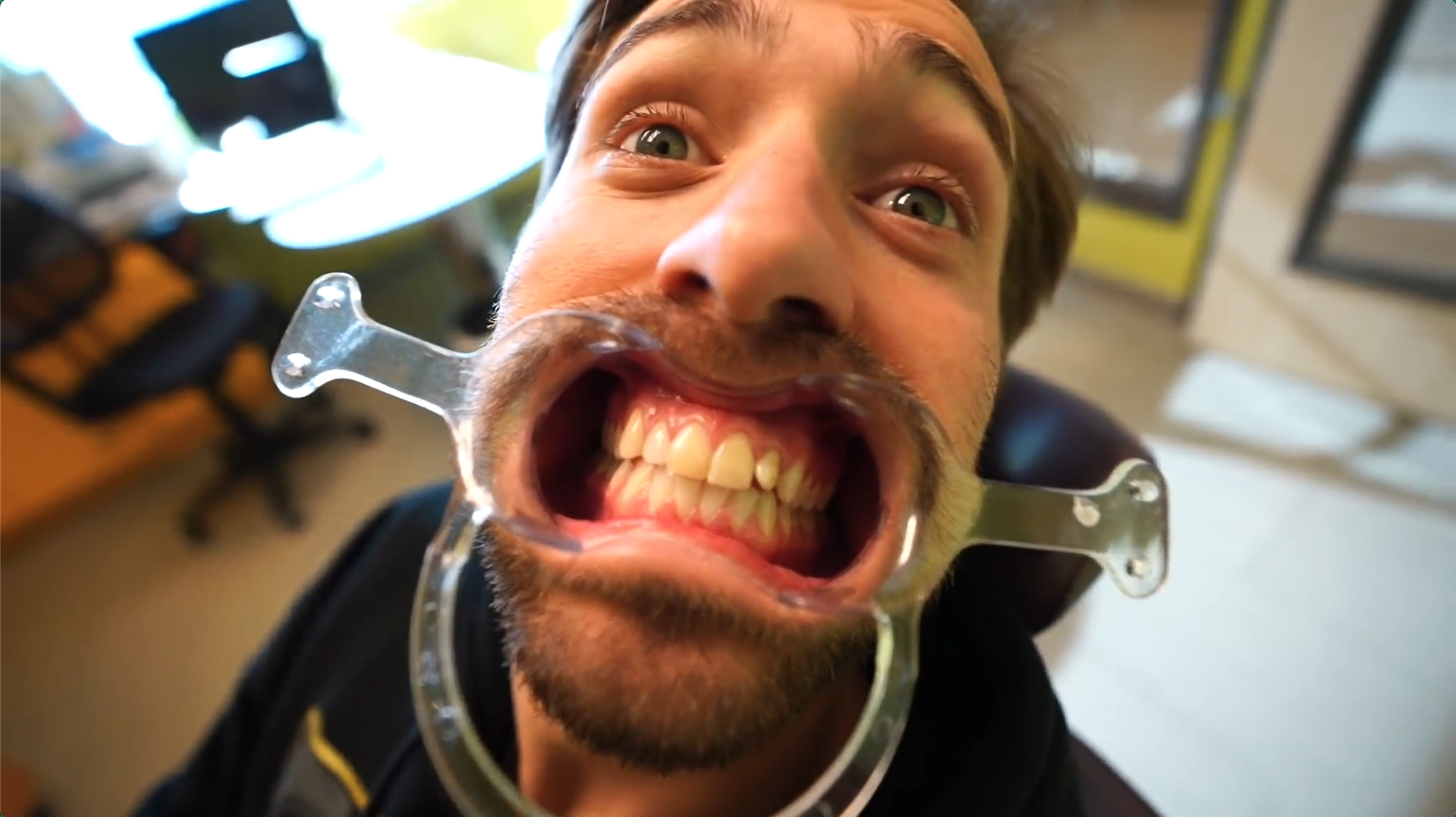Invisalign - Teens & Moms