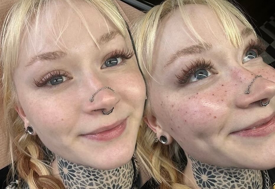 The cutest faux freckles by @beteldeetz_pmu  get your sun kissed look just in time for summer, visit us online at hotstuffstudioilm.com to book