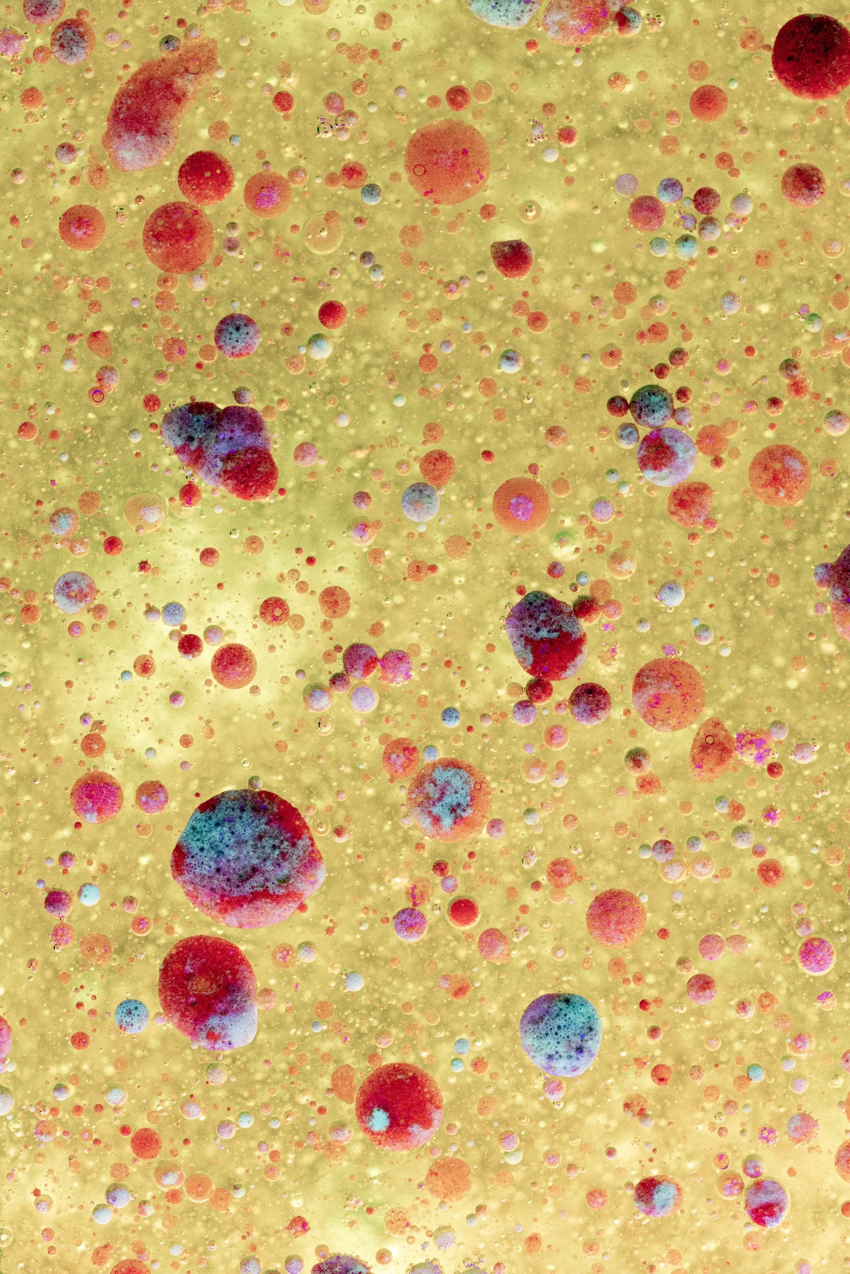 Microscopic image of gut bacteria representing small intestinal bacterial overgrowth (SIBO) — Emba Wellness Melbourne naturopath