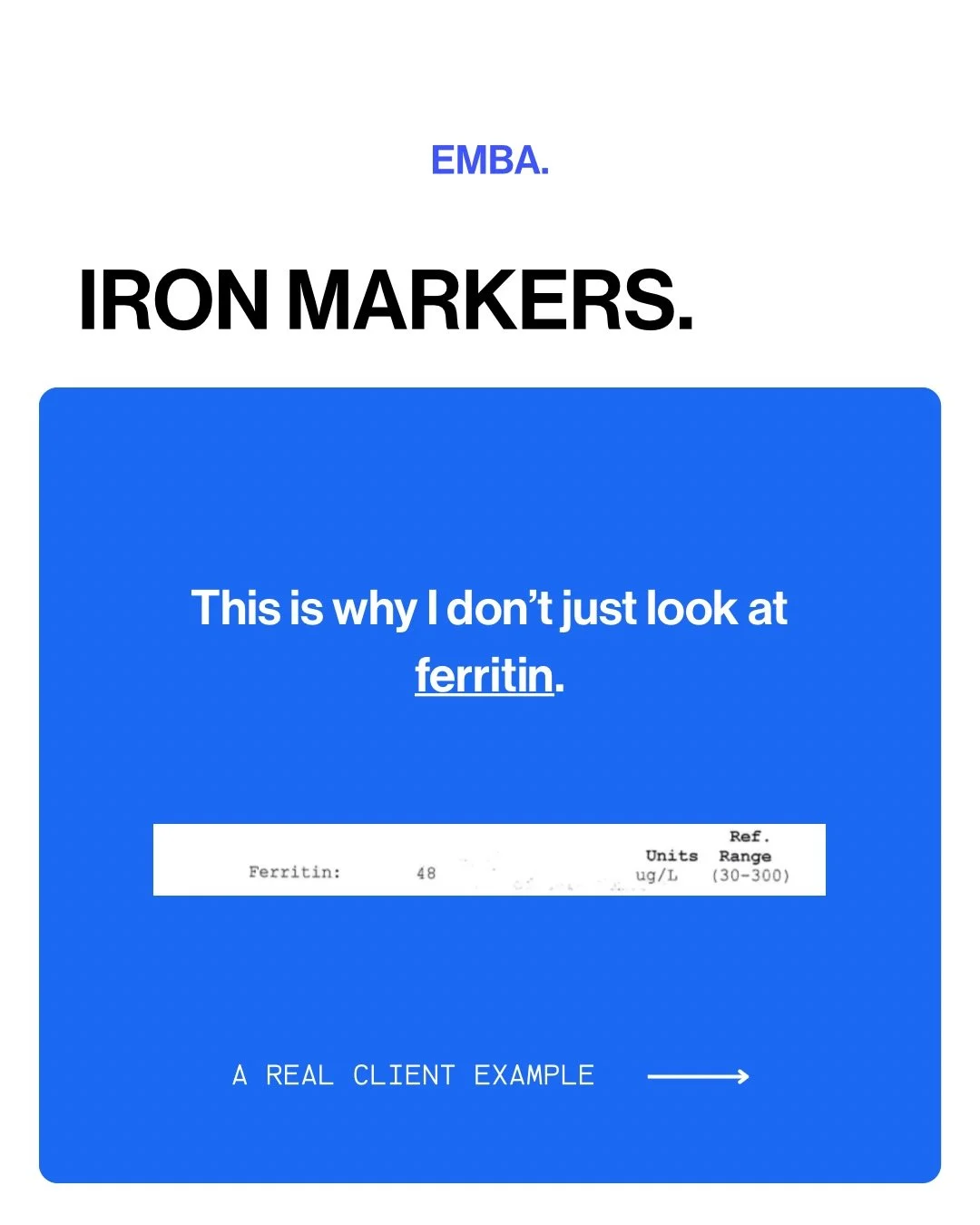 🌀Ferritin often gets most of the attention when it comes to iron.

And on its own, this result might not raise immediate concern.

But iron isn&rsquo;t just about storage.

When we look at the full panel - serum iron, transferrin, transferrin satura