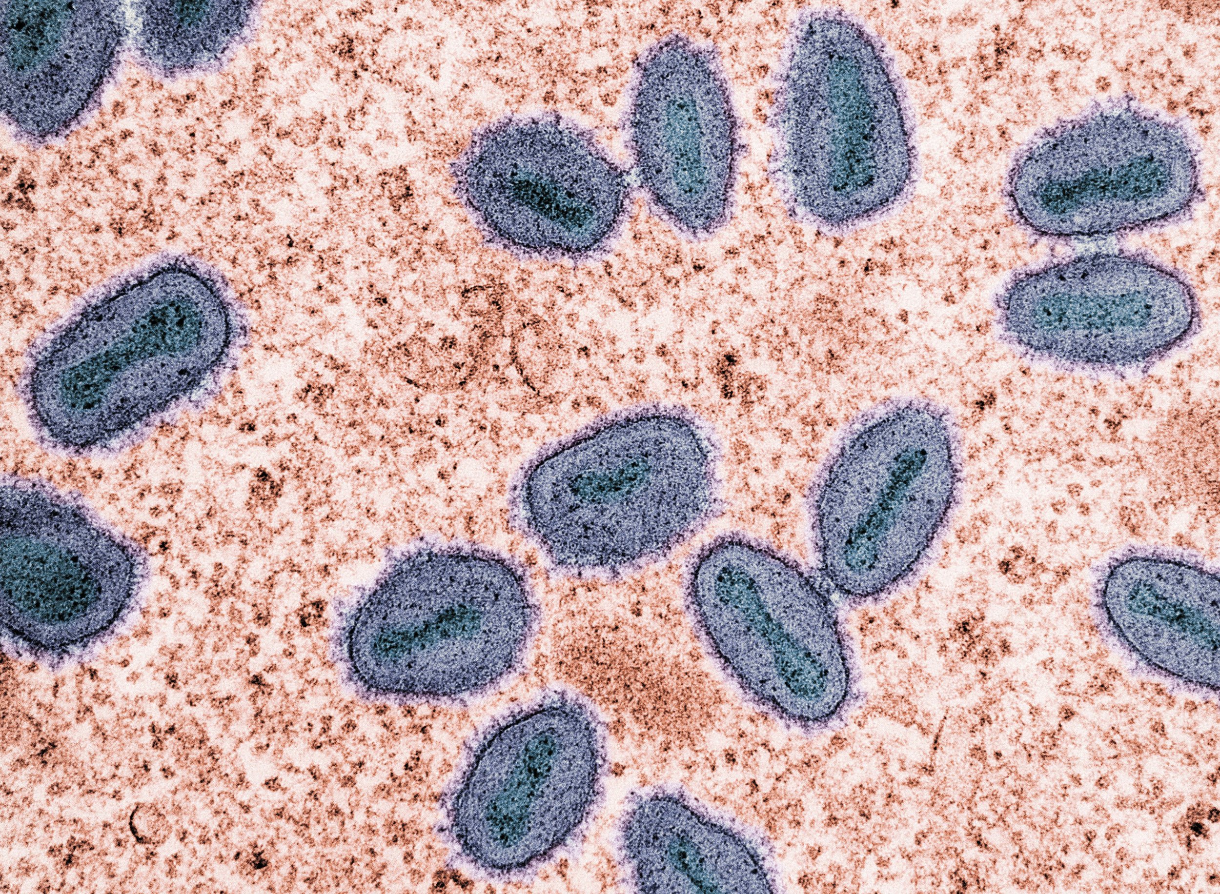 Electron microscope image of gut bacteria illustrating the impact of antibiotics on beneficial microbiome strains — Emba Wellness naturopath