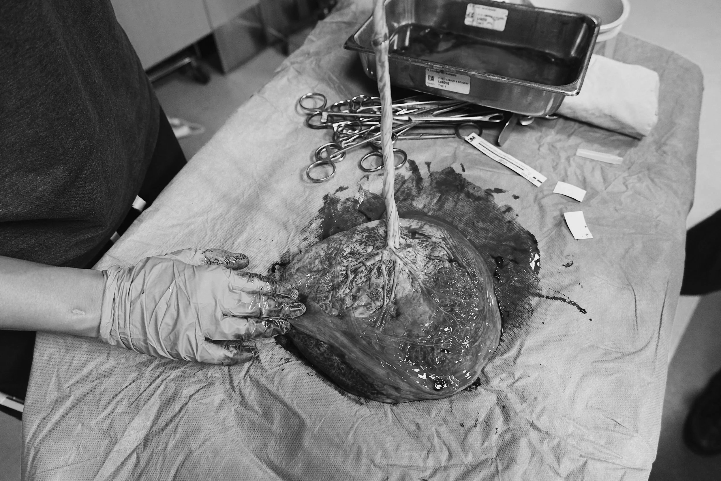 Toronto Lotus Birth Possible Ontario Placenta Practices