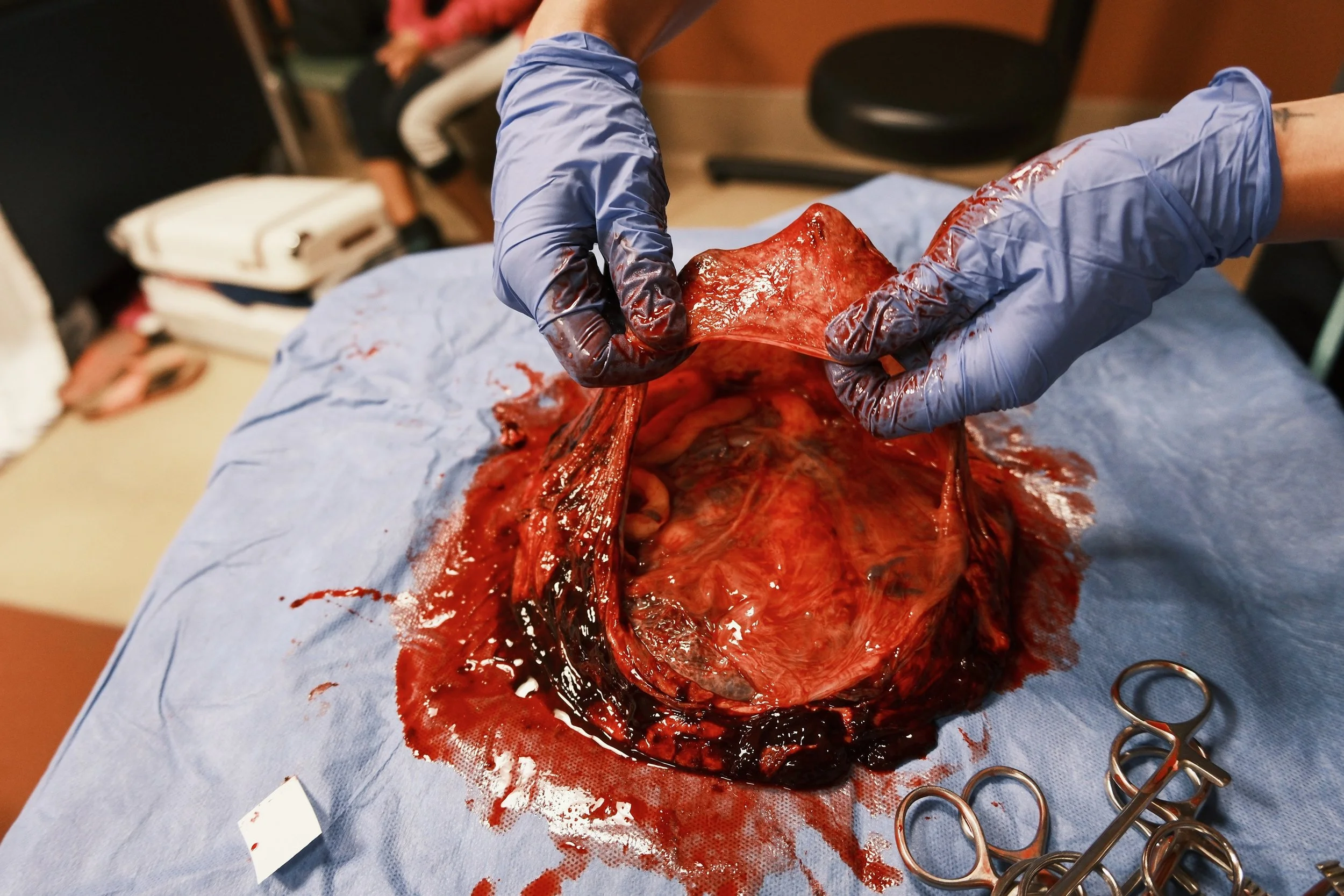 Placenta Art Toronto