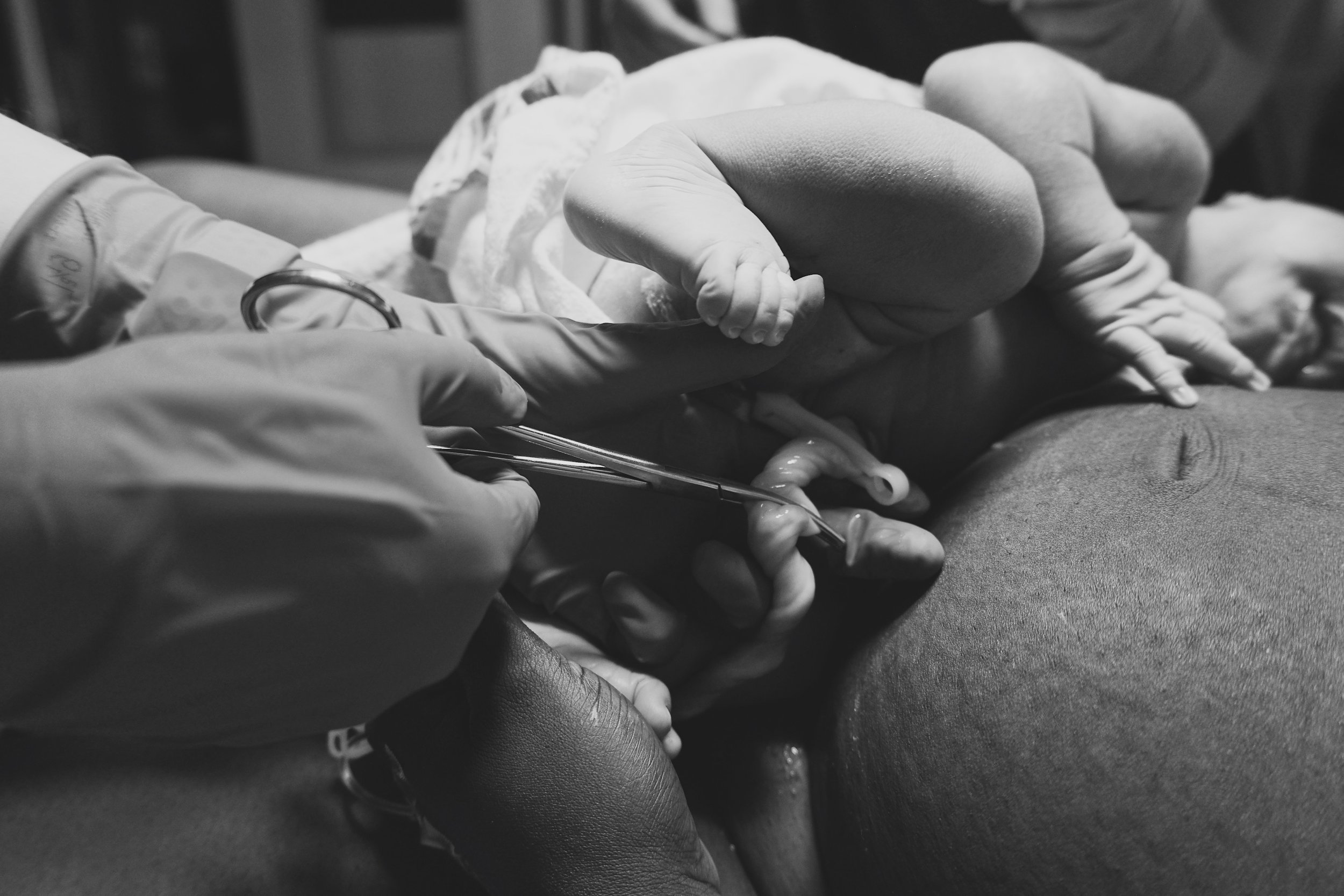 Toronto Birth Photography Cutting the Umbilical Cord Delayed Toronto Mount Sinai