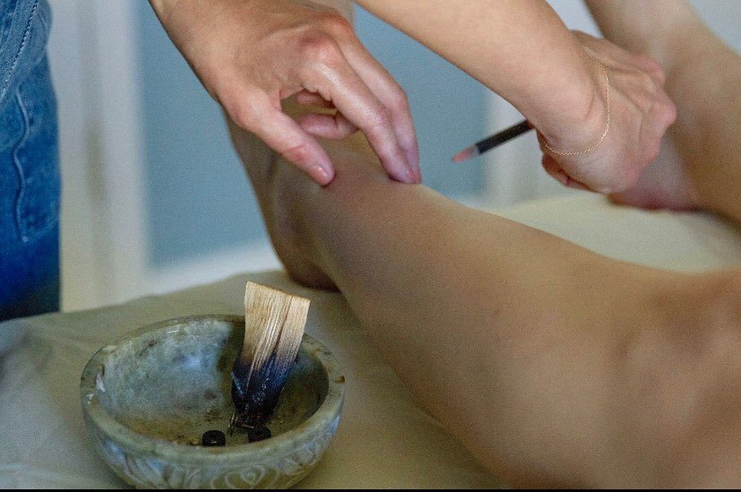 Moxibustion 🔥☄️🎇A heat therapy used in Traditional Chinese Medicine and commonly used alongside regular acupuncture treatments. Dried mugwort (called &ldquo;moxa&rdquo;) is formed into sticks or cones and then burned on or close to the skin&rsquo;s