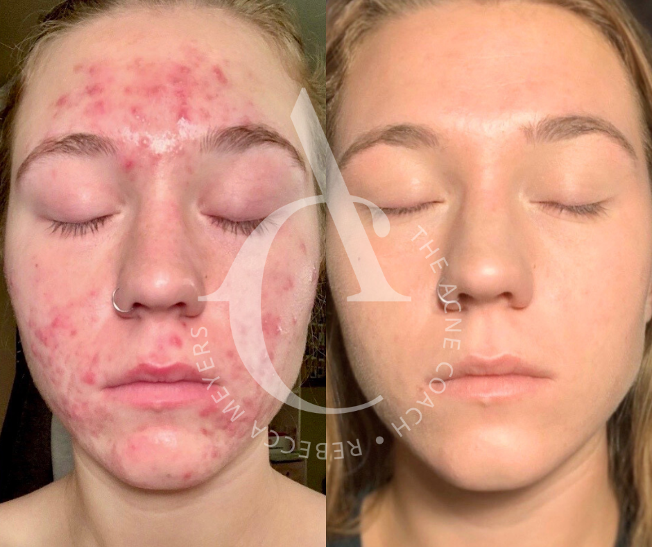 Elements Skin Care & Acne Clinic