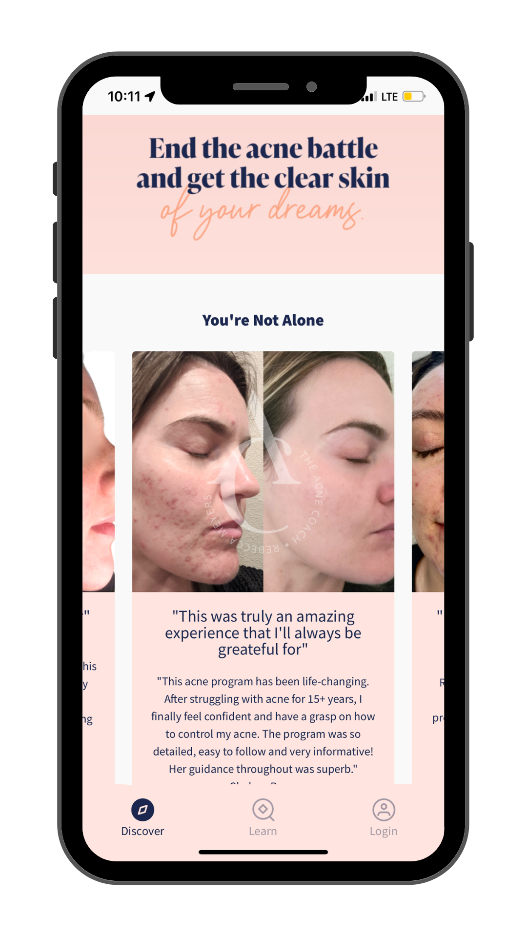 Our Services Elements Skin Care & Acne Clinic in Anchorage, Alaska — Elements Skin Care & Acne