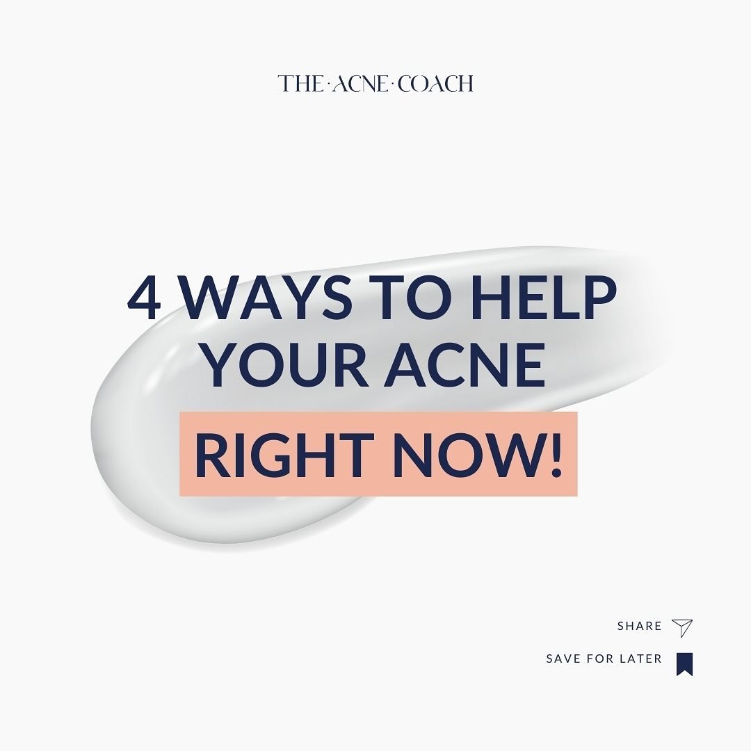 If you&rsquo;re looking for immediate acne solutions here are 4 things I recommend you do right now!

Want more acne tips to keep your skin clear? ✨ Follow @theacnecoach for more! 

#acne #acneexpert #acnetips #acneproblems #acnesolution #acnesolutio