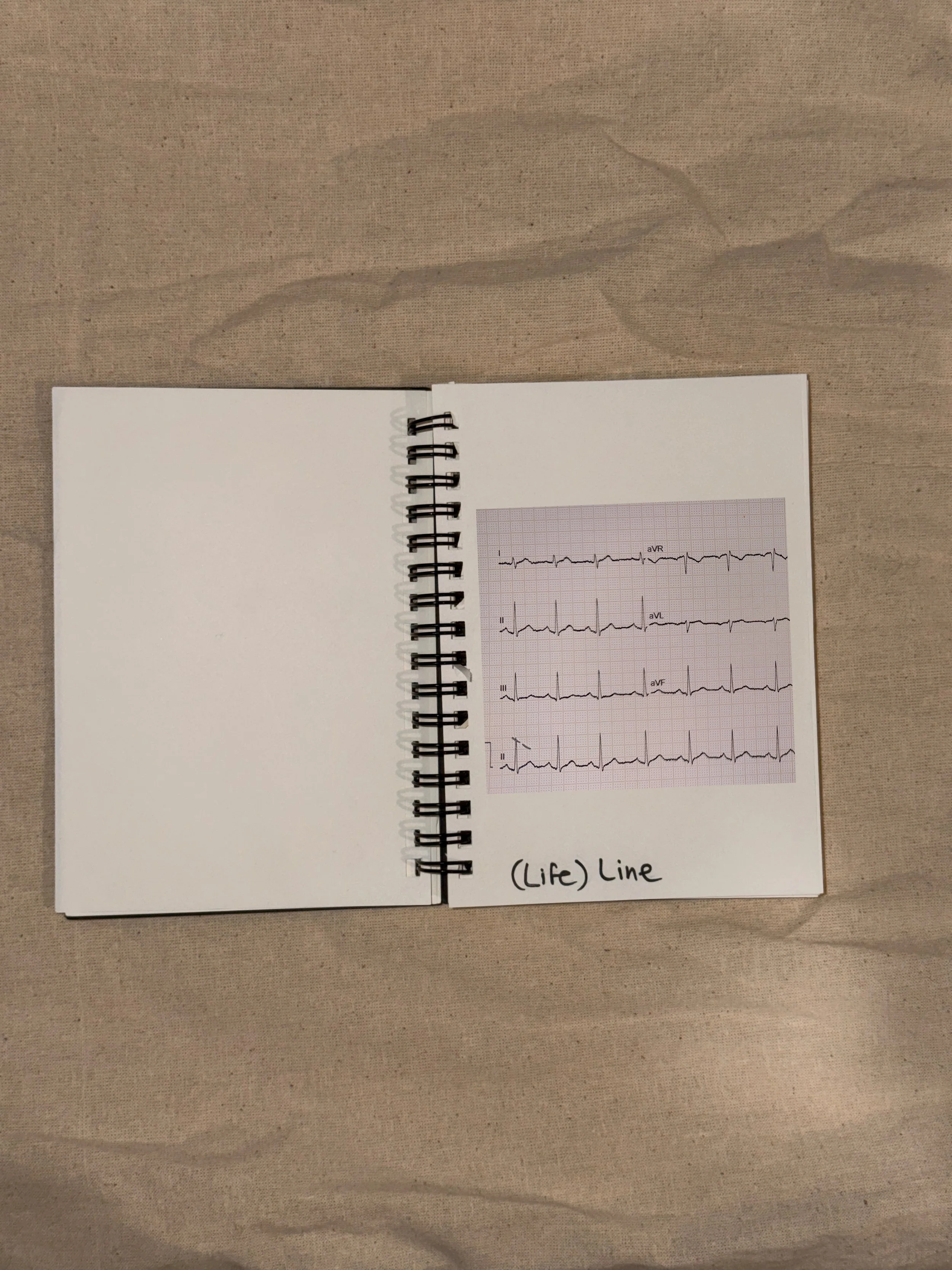 A heartbeat waveform appears. The line now represents biological time.