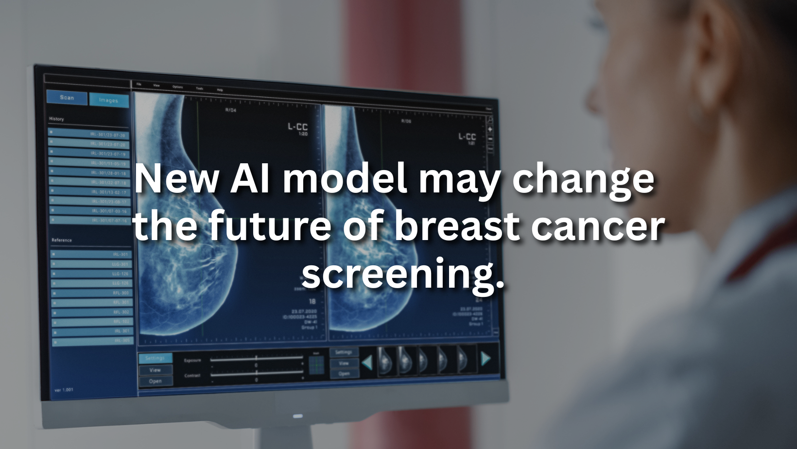 New AI model may change the future of breast cancer screening.