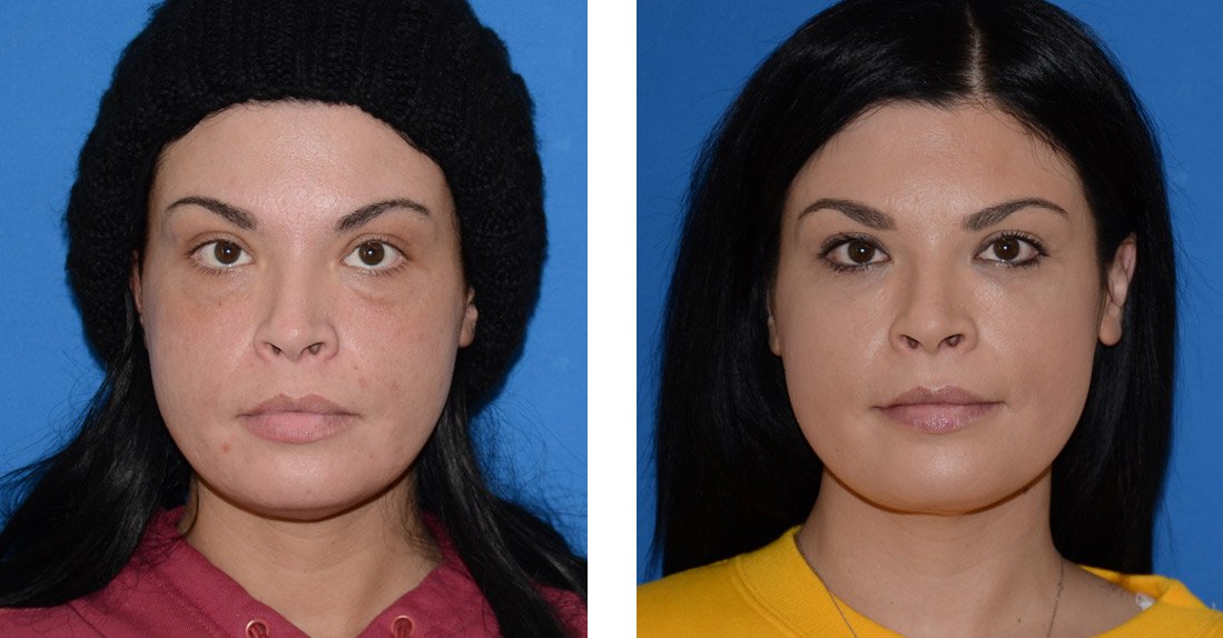  Before (left) After (right) 