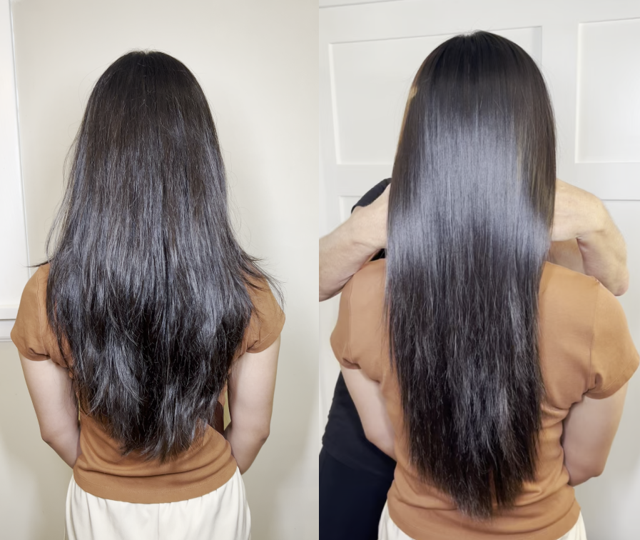 Angele Before and after treatment 4.png