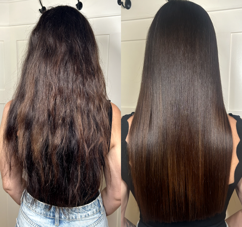 Angele Before and after treatment 1.png