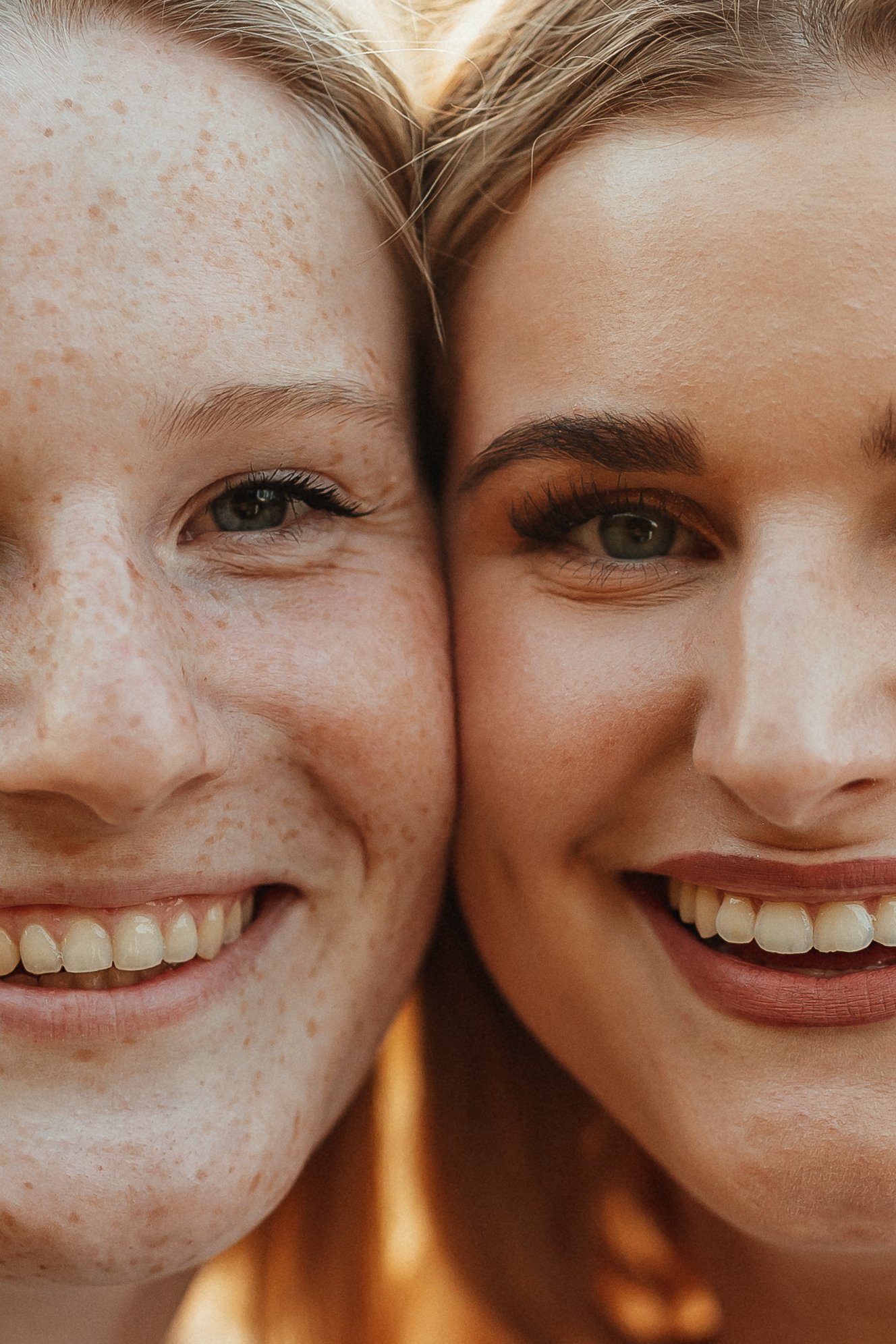 Nahaufnahme von zwei lachenden Frauen, die eng beieinander stehen, mit sichtbaren Zähnen und unterschiedlichen Hautmerkmalen wie Sommersprossen.