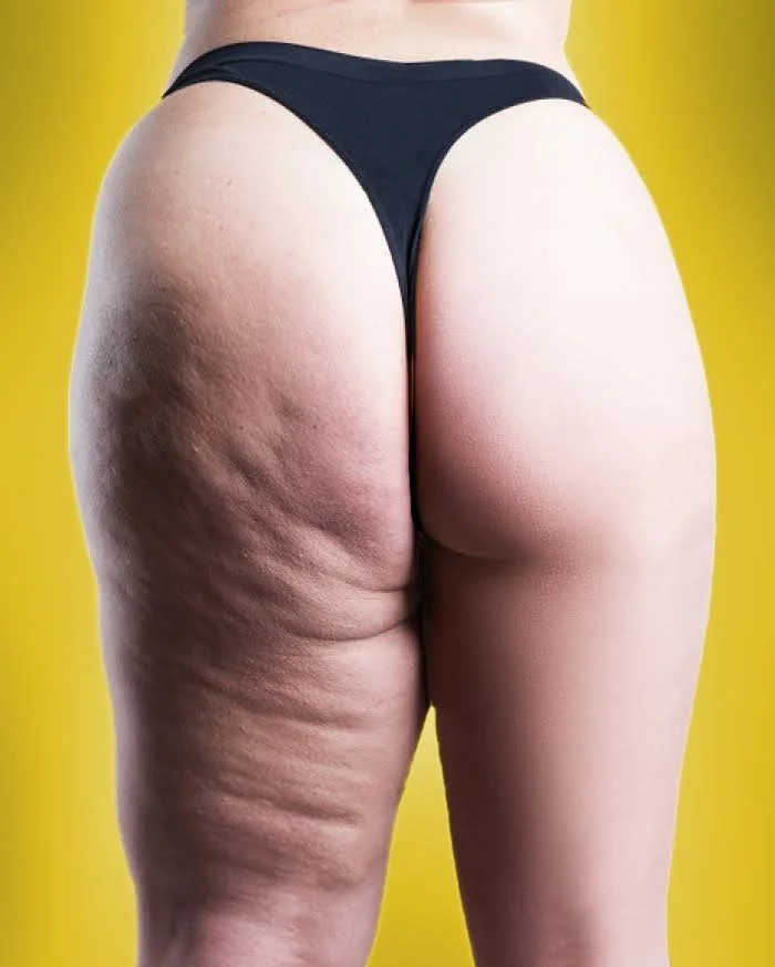 No Shame weight and body image artwork. (Copy) (Copy)
