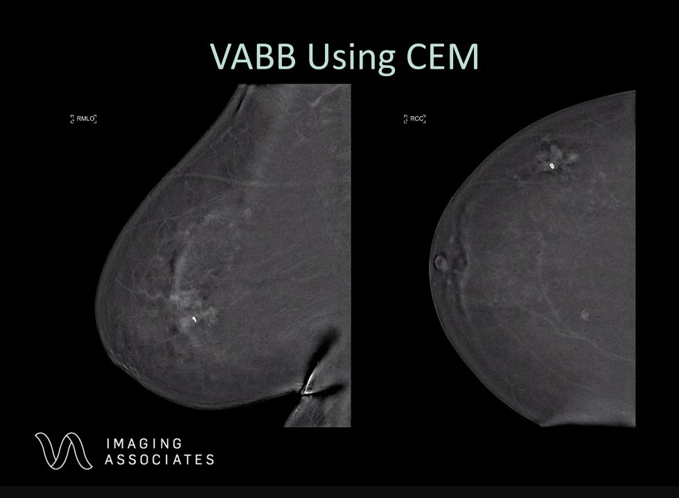 Breast Imaging Course
