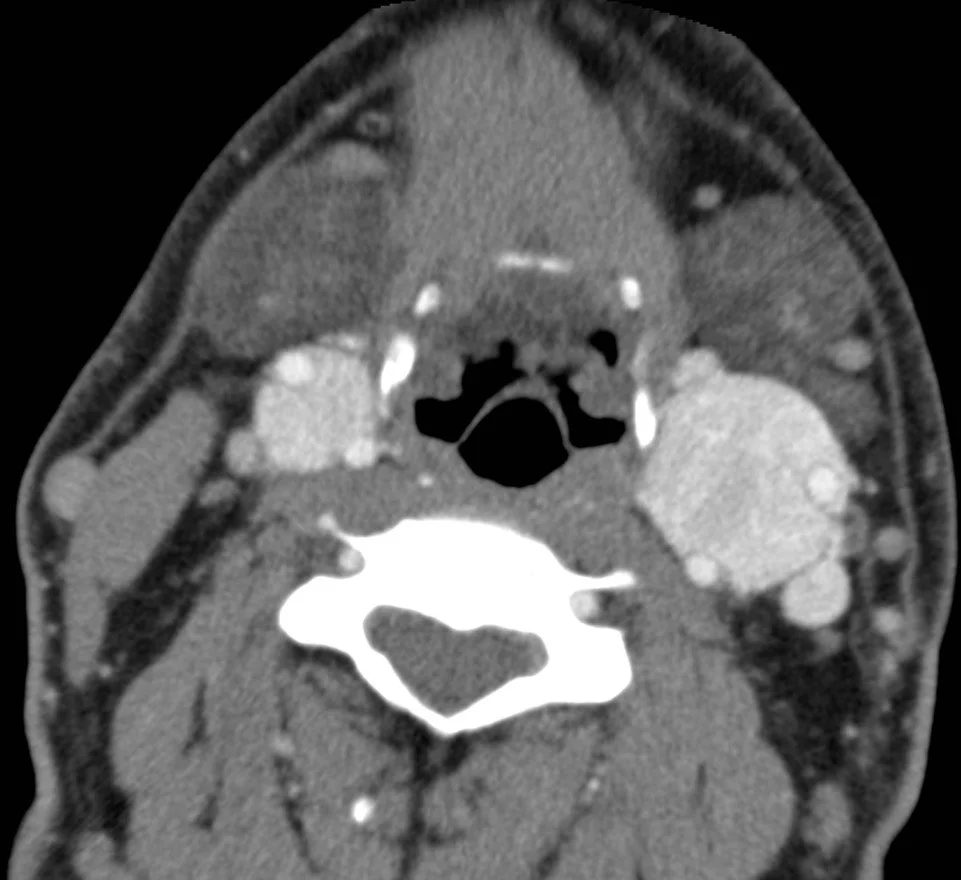 Head and Neck Imaging Course
