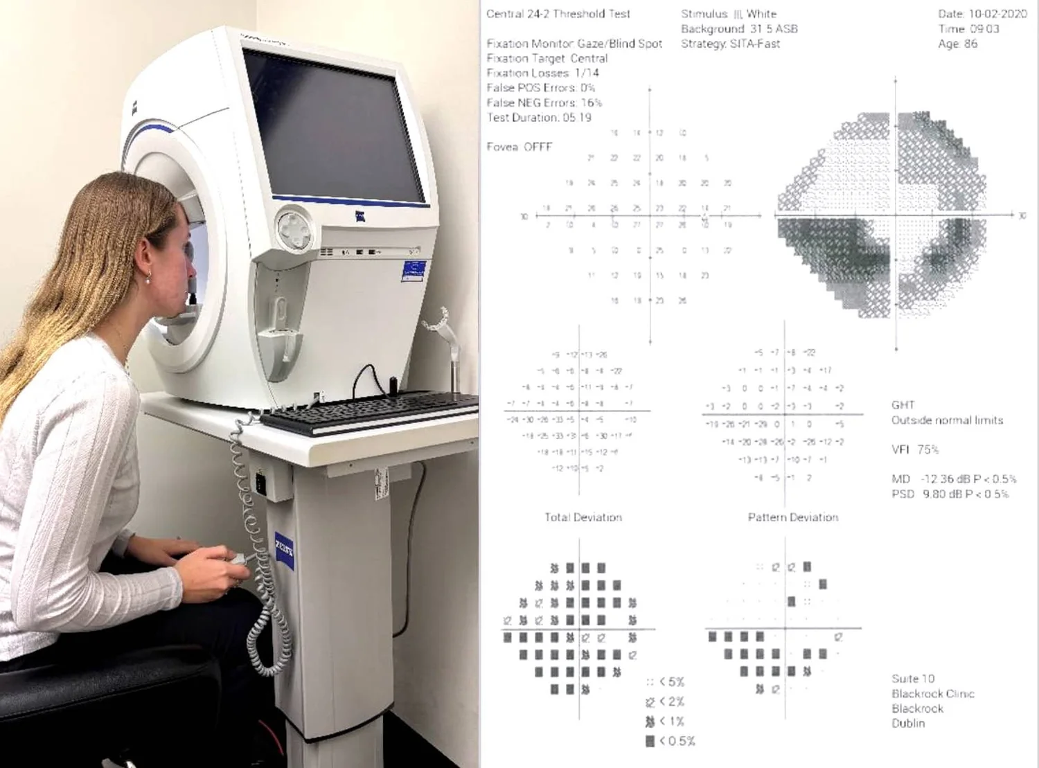 Visual Field Testing Optometry Review Visual Field Testing, OCT, and Retinal Photography | Design Eyewear ...