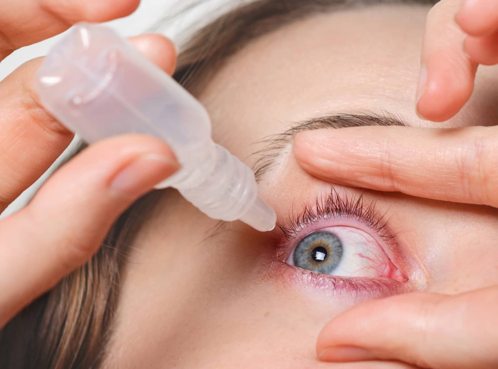 dry-eye-treatment-in-adelaide-cbd