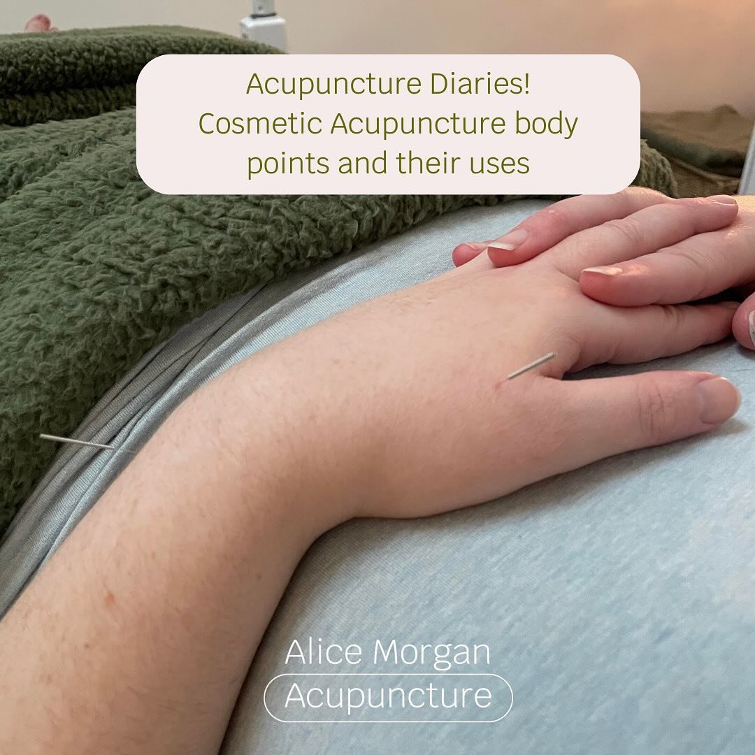 The Acupuncture Diaries ✏️ 

Welcome to the acupuncture diaries where I will explain the body points and how I use them in treatments!
 Cosmetic Acupuncture doesn&rsquo;t just involve the use of needles on the face.
Cosmetic Acupuncture uses the deep