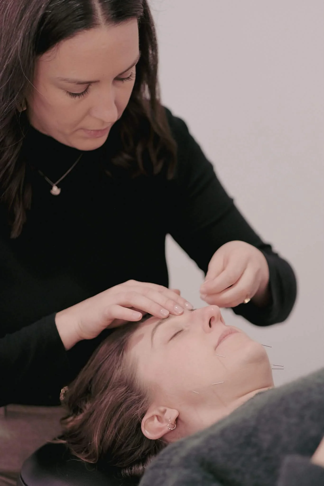 A professional acupuncturist performing a cosmetic acupuncture treatment on a client's face for skin rejuvenation