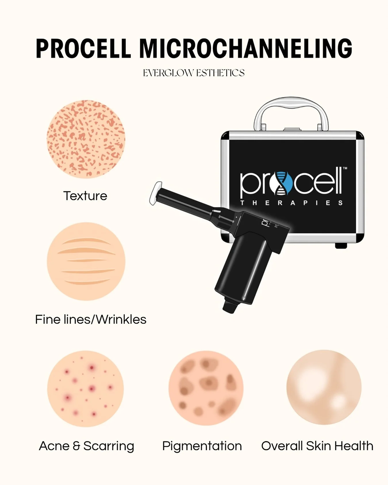 Want a skin glow up? Procell Microchanneling is THAT girl.⁣
⁣
Microchanneling creates tiny, controlled channels into the skin inducting collagen production. Essentially creating new healthy skin! Paired with our stem cell serums that help to stimulat