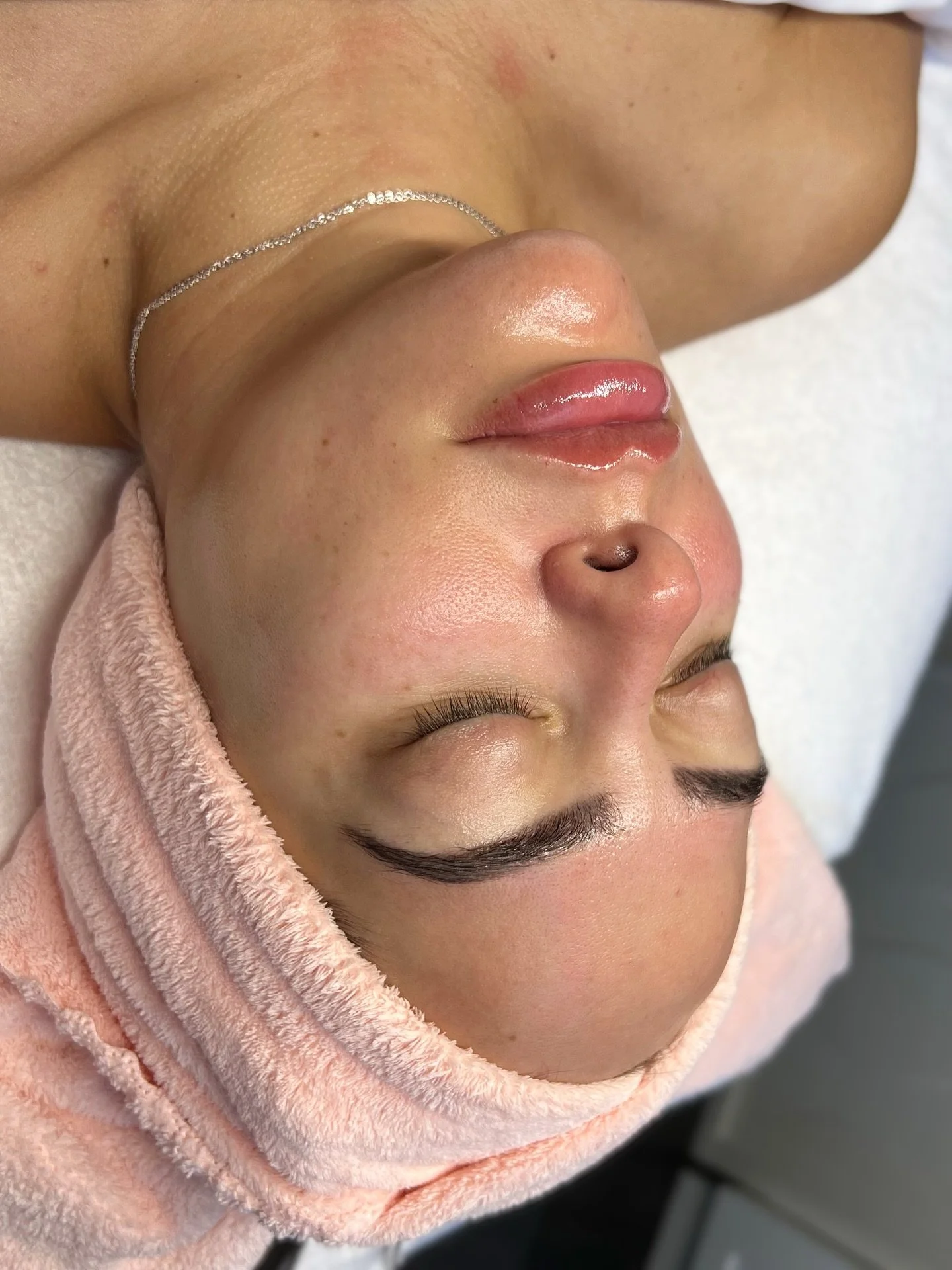 Hydrofacial Glow 💫 SWIPE for her before!

Our 𝐇𝐲𝐝𝐫𝐨𝐝𝐞𝐫𝐦𝐚𝐛𝐫𝐚𝐬𝐢𝐨𝐧 𝐋𝐮𝐱𝐞 𝐓𝐫𝐞𝐚𝐭𝐦𝐞𝐧𝐭 gives the ultimate single treatment glow up including:

✨Dermaplane
✨Oxygen Mask + Steam
✨Hydrodermabrasion Deep Cleanse
✨Completely Custom 