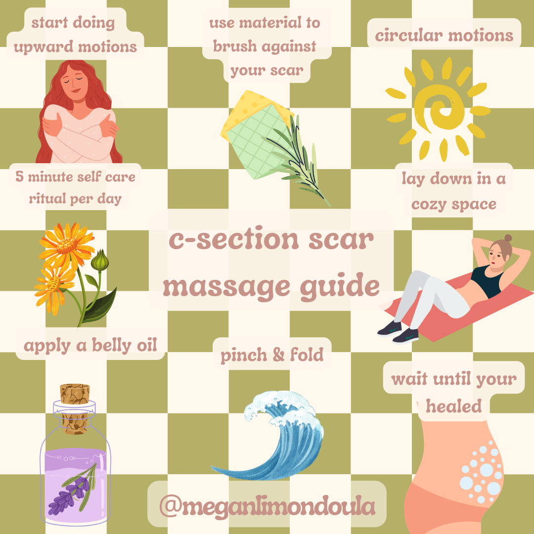 My C-section Scar Massage Guide