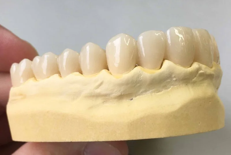 Kiefermodell mit künstlichen Zähnen aus Keramik