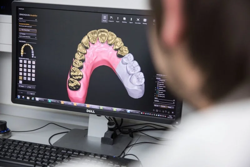 Ein Zahnarzt betrachtet einen digitalen Kieferabdruck auf einem Computerbildschirm.