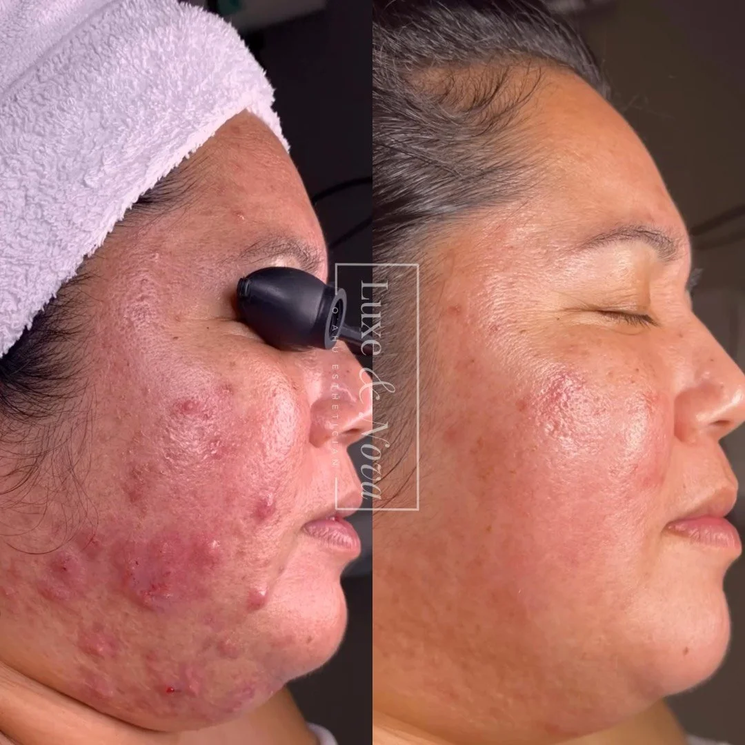 Luxe and Nova Before and After 2.jpeg