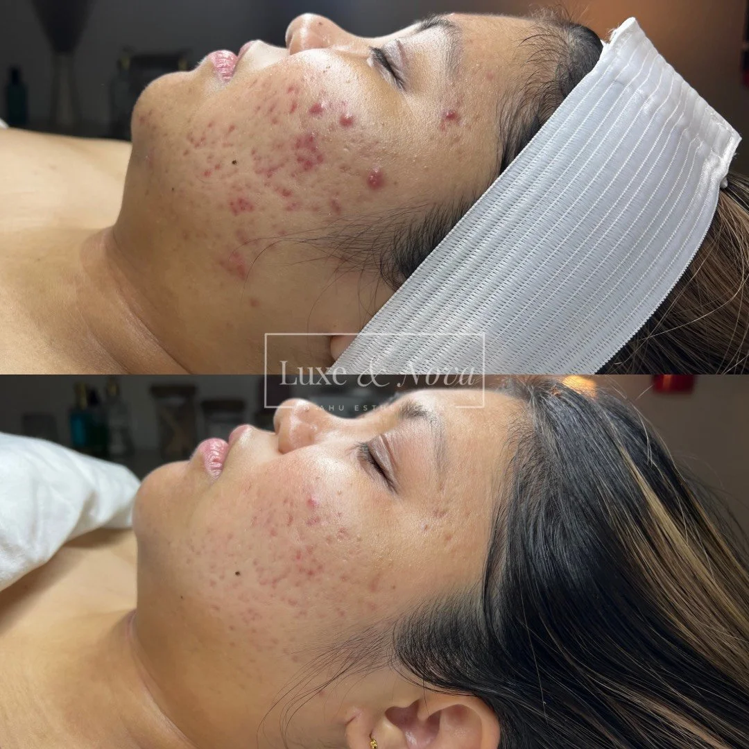 Luxe and Nova Before and After 1.jpeg