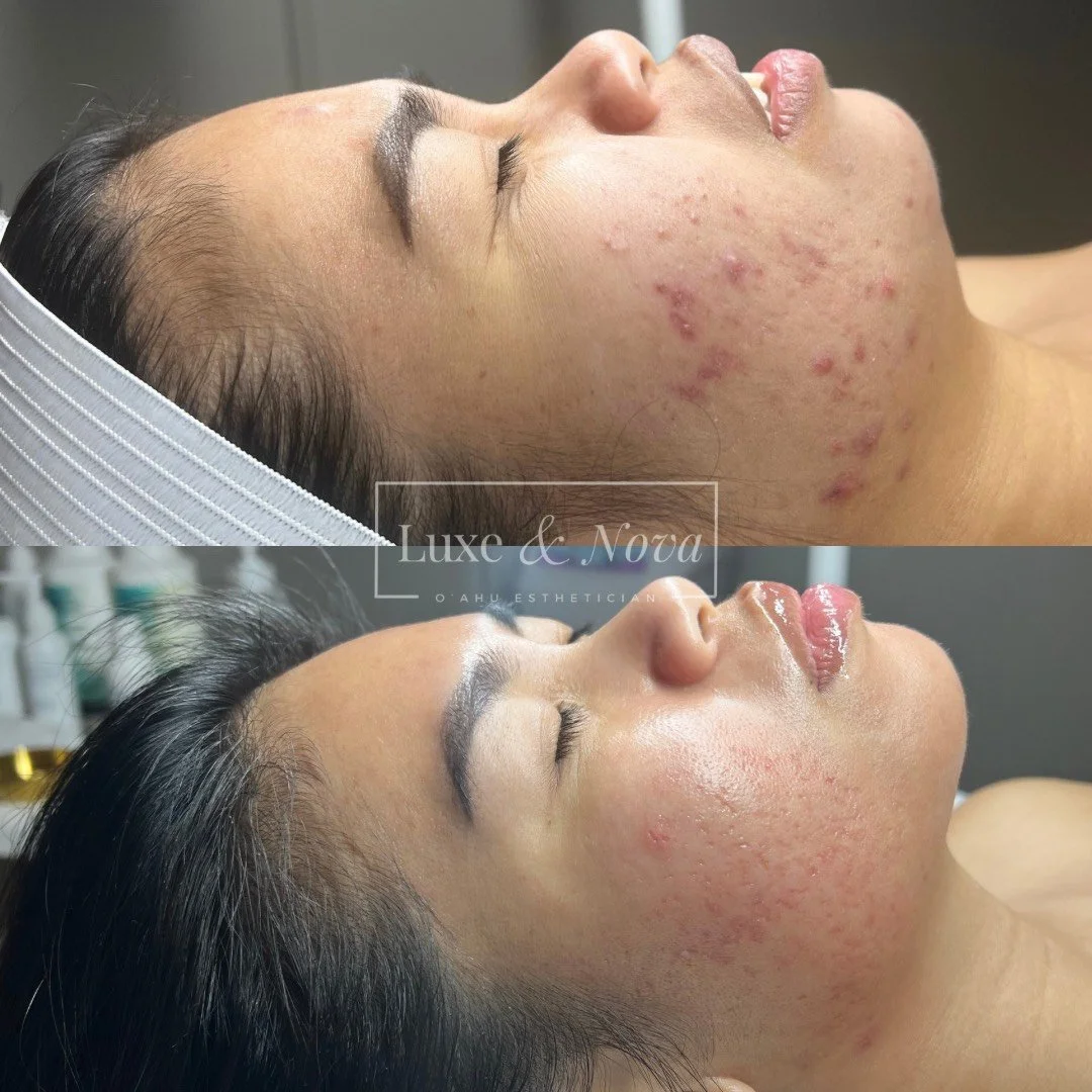 Luxe and Nova Before and After 3.jpeg