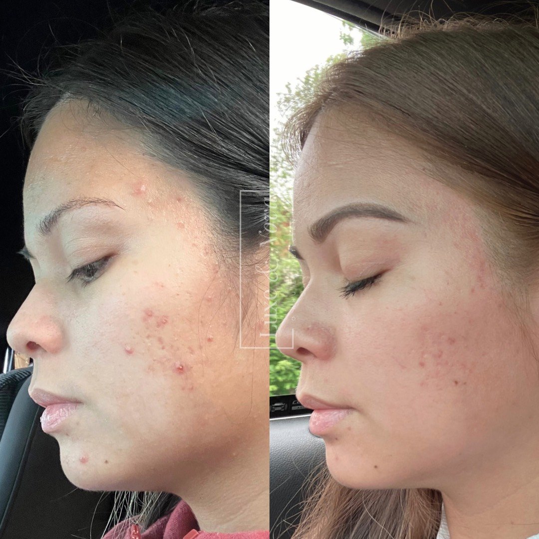 Luxe and Nova Before and After 4.jpeg