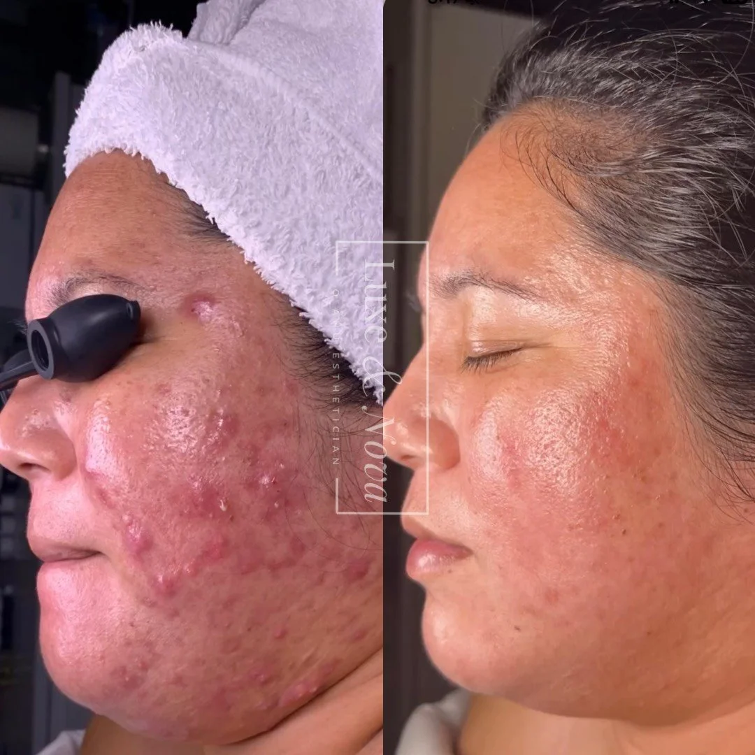 Luxe and Nova Before and After 5.jpeg