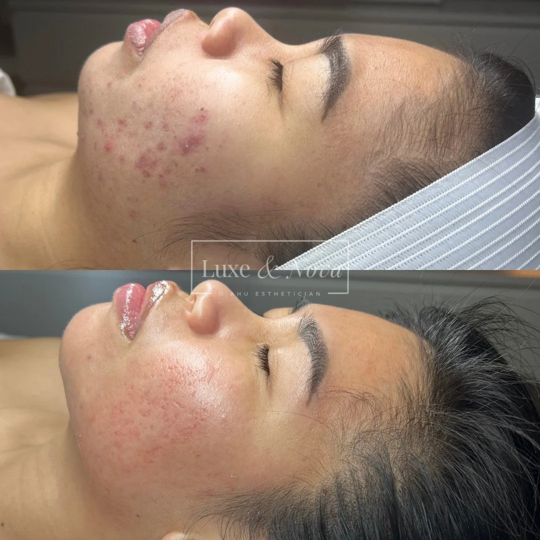 Luxe and Nova Before and After 6.jpeg