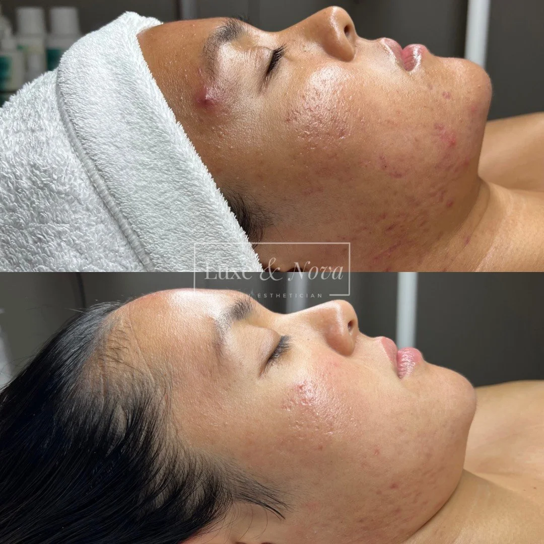 Luxe and Nova Before and After 7.jpeg