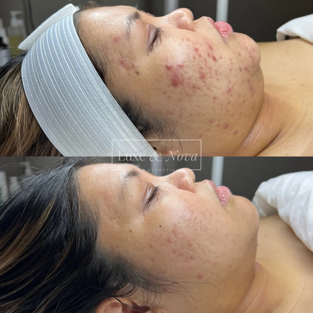Luxe and Nova Before and After 8.jpeg