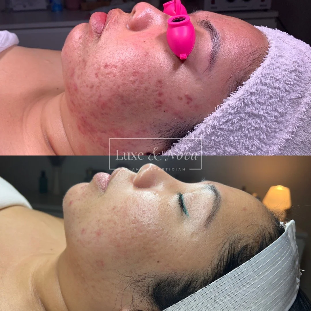 Luxe and Nova Before and After 9.jpeg