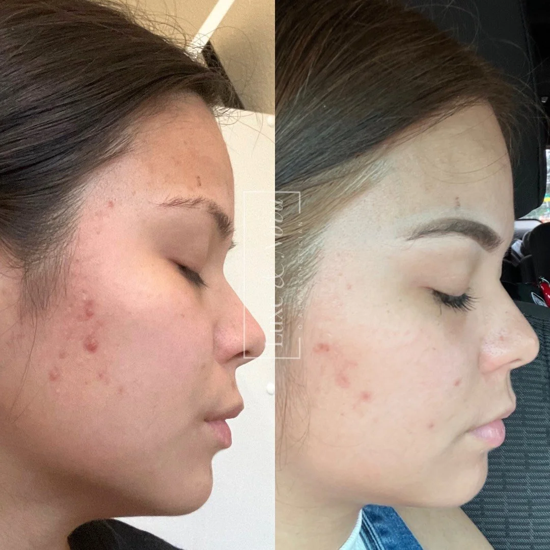 Luxe and Nova Before and After 11.jpeg