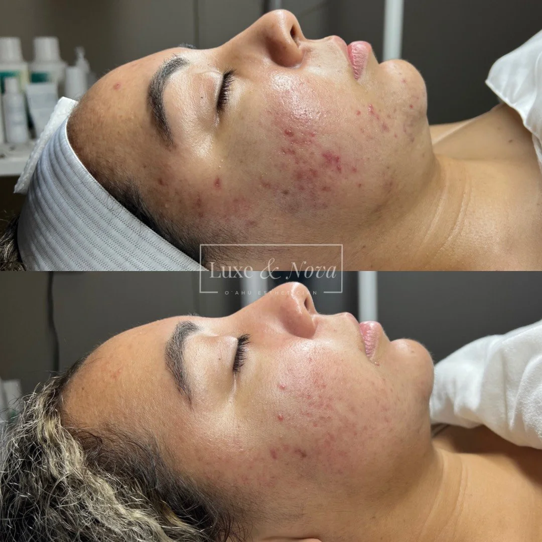 Luxe and Nova Before and After 12.jpeg